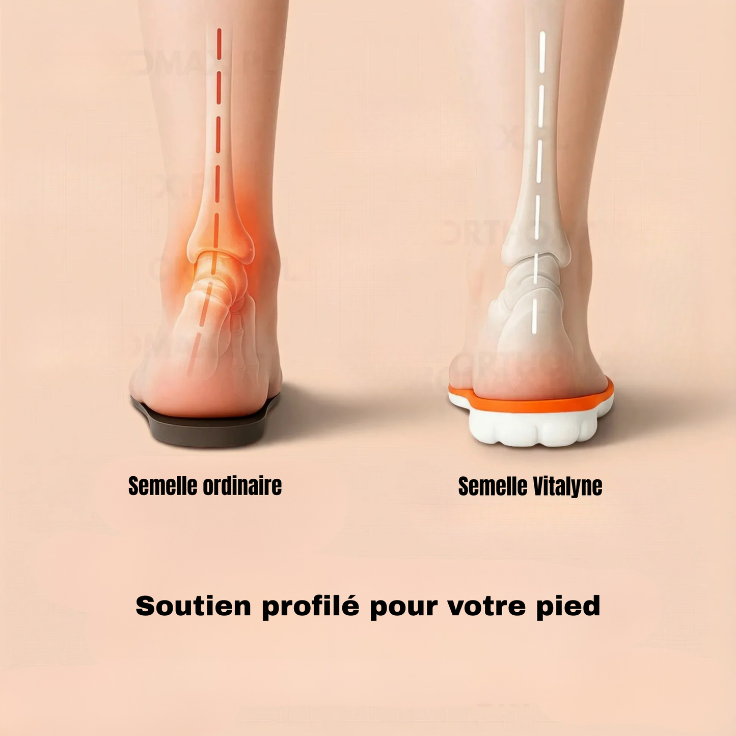 Semelle orthopédique